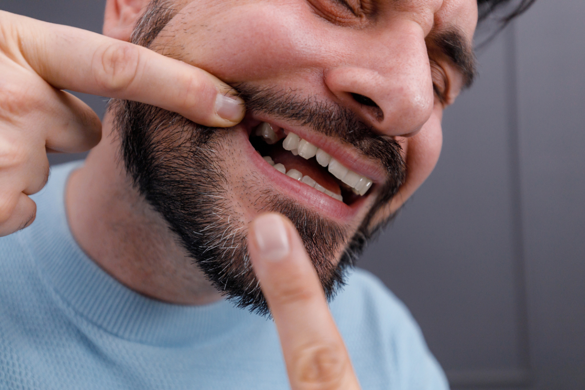 Featured image for Can Veneers Replace Missing Teeth?