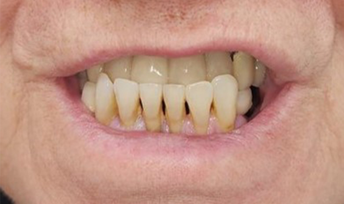 Before image