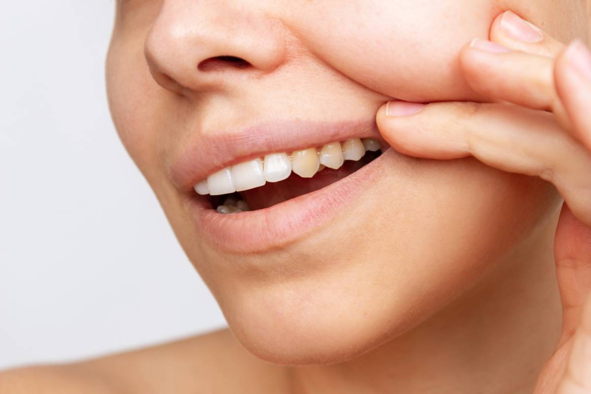 Cropped shot of a young woman showing shows yellow teeth.
